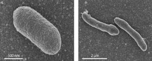 Twee vormen van E. coli