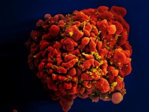 Hiv geïnfecteerde T-cel