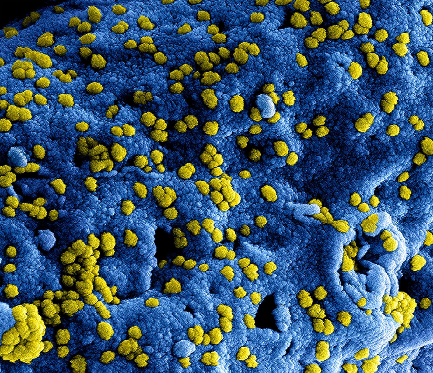 MERS-virus waarschijnlijk geen wereldwijde epidemie - New Scientist2048 x 1765