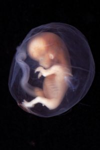 foetus 