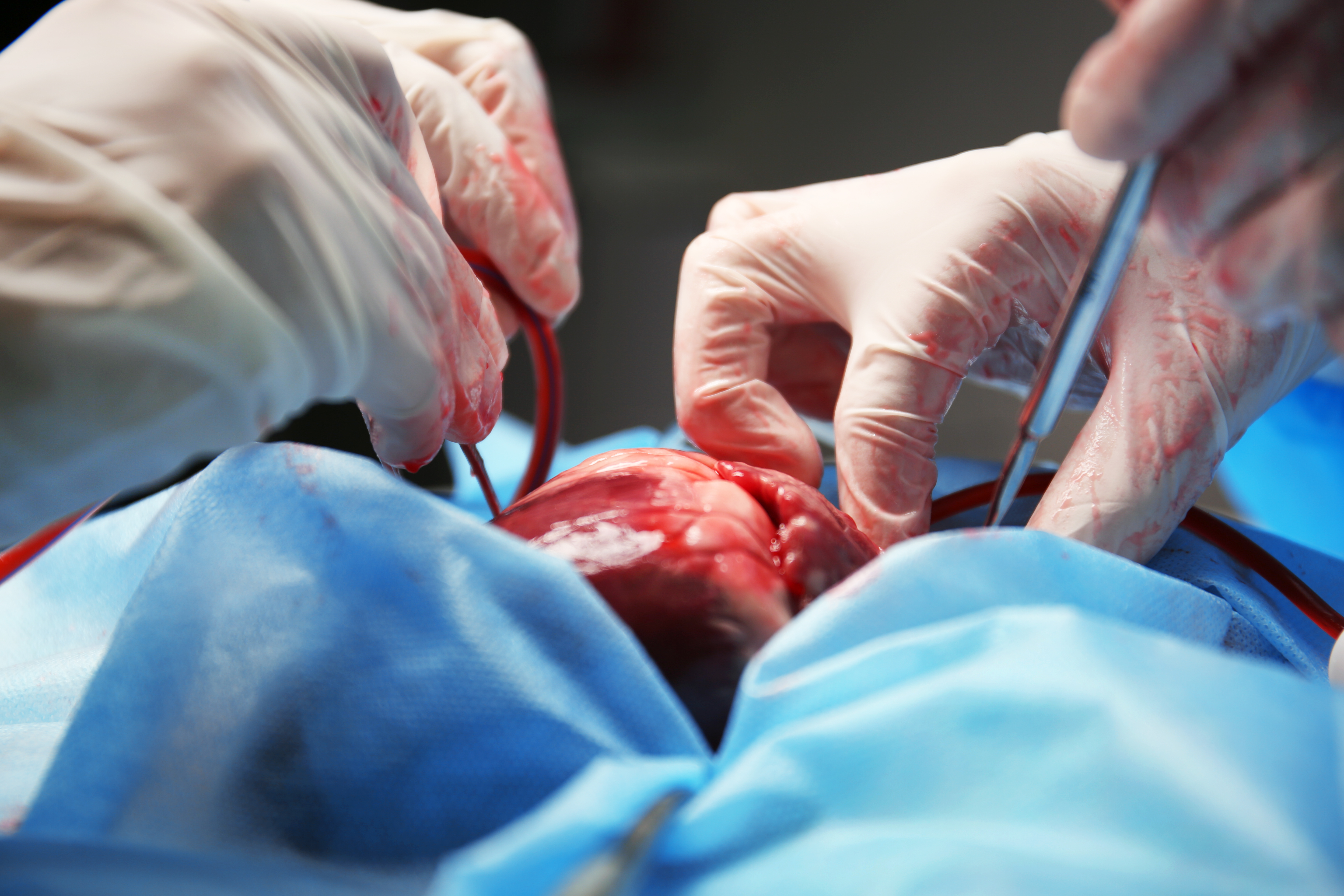 Bloedstollende operatiescènes in Het hart. Beeld: Shutterstock